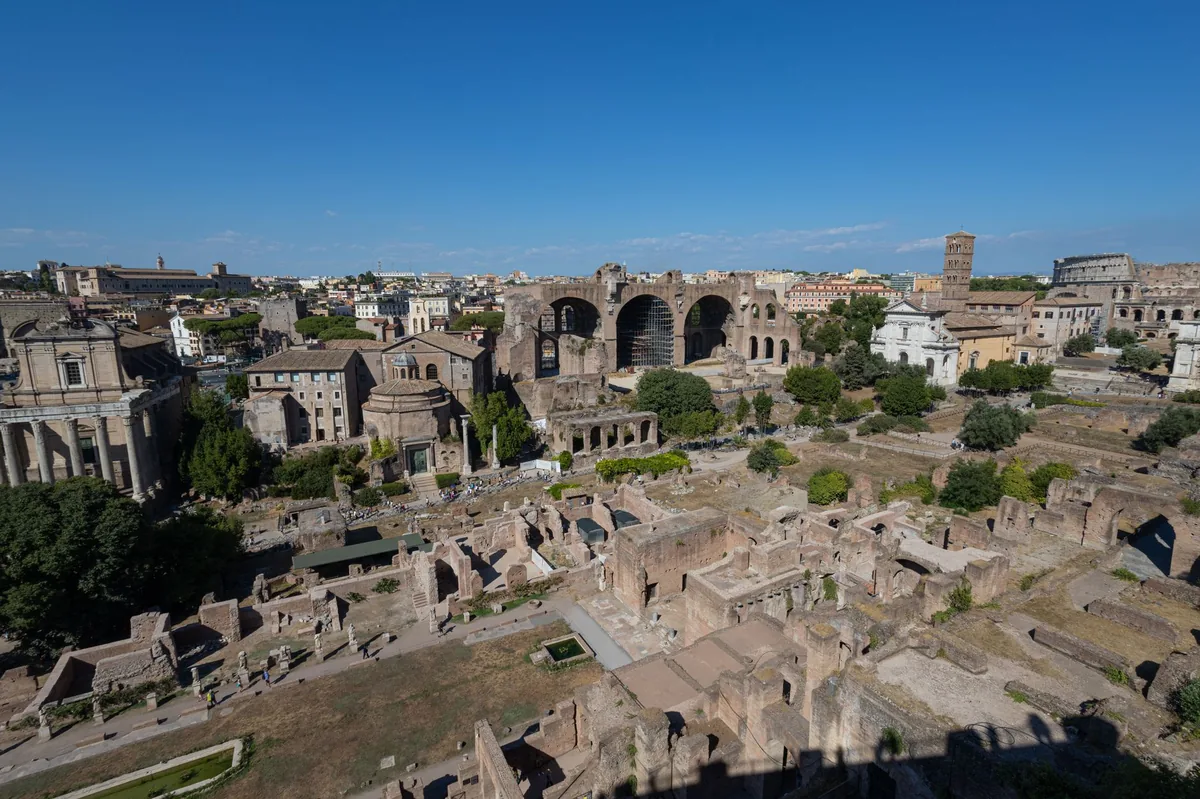 INTERVENCIÓN EN ROMA | El Papa León XIV fue operado con éxito de un adenocarcinoma pulmonar