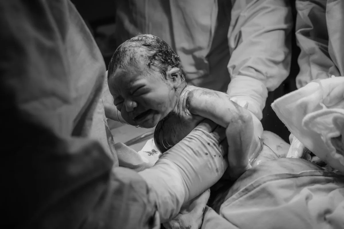 AVANCE MÉDICO EN PEDIATRÍA | Cirugía cardíaca inédita en el Garrahan salva la vida de una beba con bajo peso